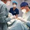 bước 3 quy trình cắt mí ilid