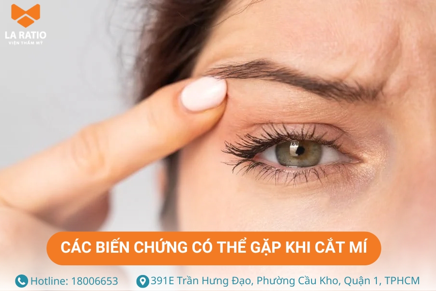 Những biến chứng về mắt có thể gặp khi cắt mí mắt Những biến chứng về mắt có thể gặp khi cắt mí mắt