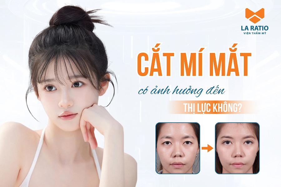 Cắt mí mắt có ảnh hưởng đến thị lực không? Một số lưu ý cần biết Cắt mí mắt có ảnh hưởng đến thị lực không? Một số lưu ý cần biết