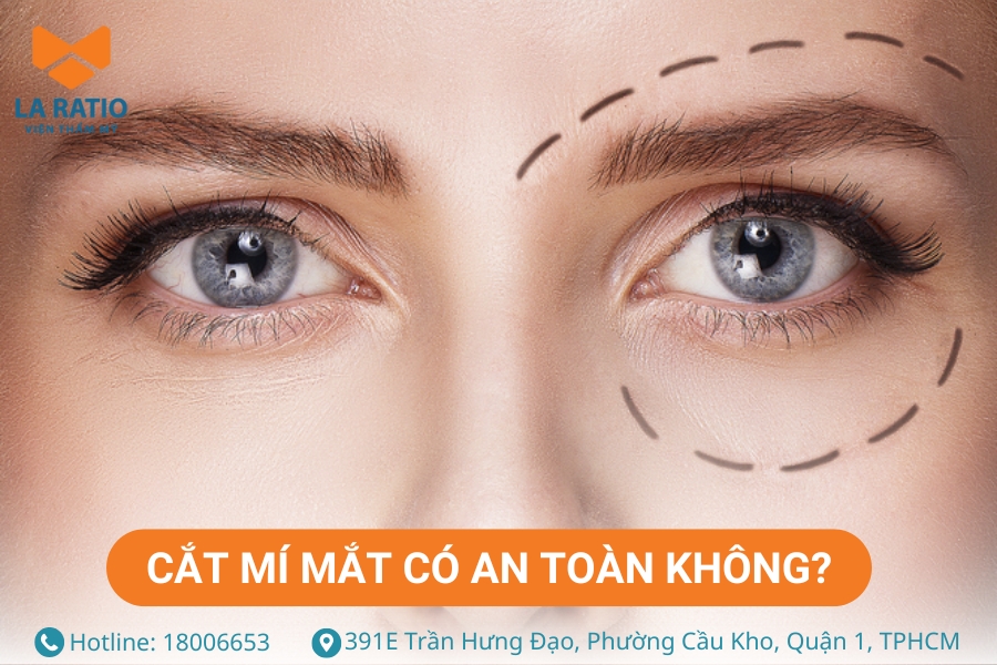 Cắt mí mắt là tiểu phẫu thẩm mỹ tương đối an toàn Cắt mí mắt là tiểu phẫu thẩm mỹ tương đối an toàn