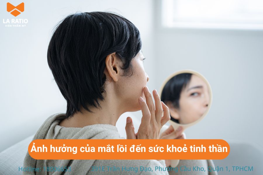 Người bị mắt lồi dễ cảm thấy căng thẳng, tự ti Người bị mắt lồi dễ cảm thấy căng thẳng, tự ti