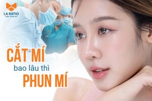 Cắt mí bao lâu thì phun mí được? Một số lưu ý cần biết