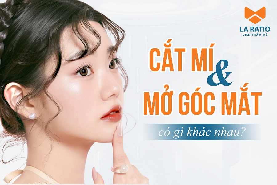 Cắt mí và mở góc mắt có gì khác nhau? Nên chọn kỹ thuật nào? Cắt mí và mở góc mắt có gì khác nhau? Nên chọn kỹ thuật nào?