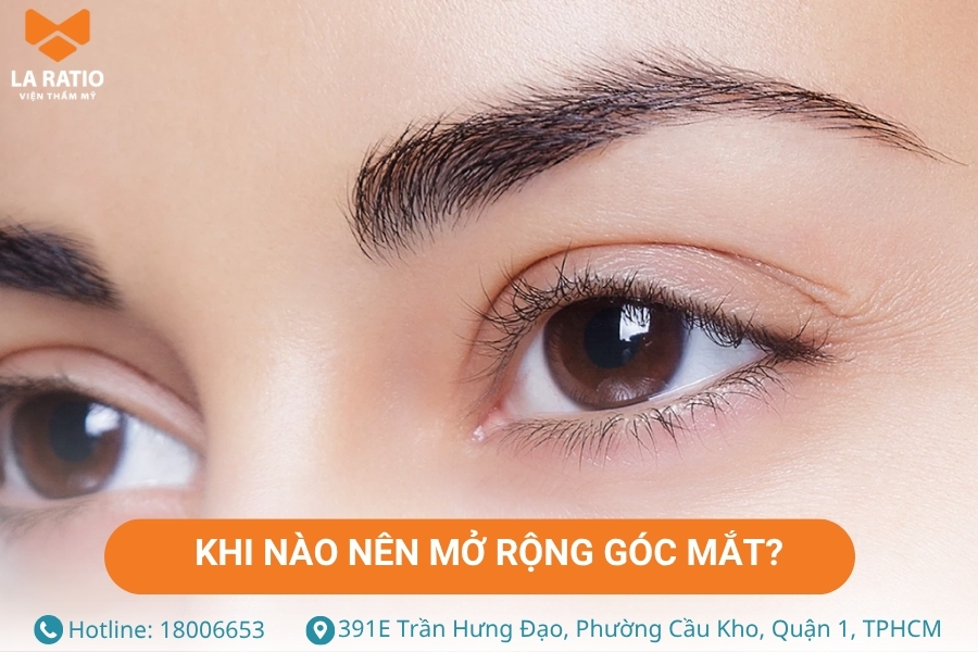 Khi nào nên lựa chọn phương pháp mở rộng góc mắt Khi nào nên lựa chọn phương pháp mở rộng góc mắt