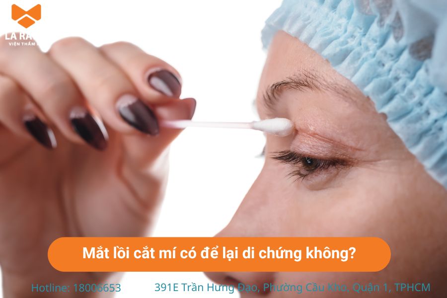 Cắt mí mắt lồi có thể để lại biến chứng nếu bác sĩ không có chuyên môn Cắt mí mắt lồi có thể để lại biến chứng nếu bác sĩ không có chuyên môn