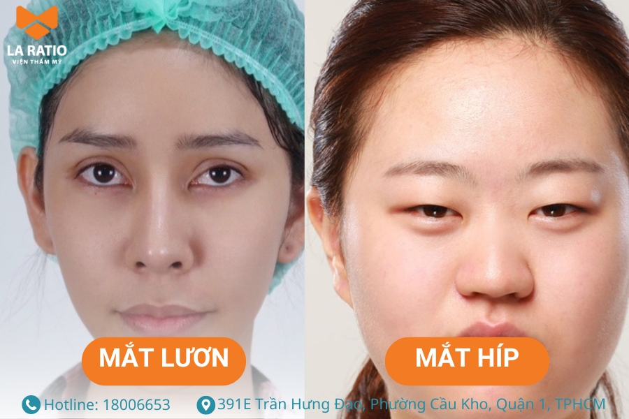 Mắt lươn dài và hẹp trong khi đó mắt híp thì lại có nếp mí rõ ràng hơn Mắt lươn dài và hẹp trong khi đó mắt híp thì lại có nếp mí rõ ràng hơn