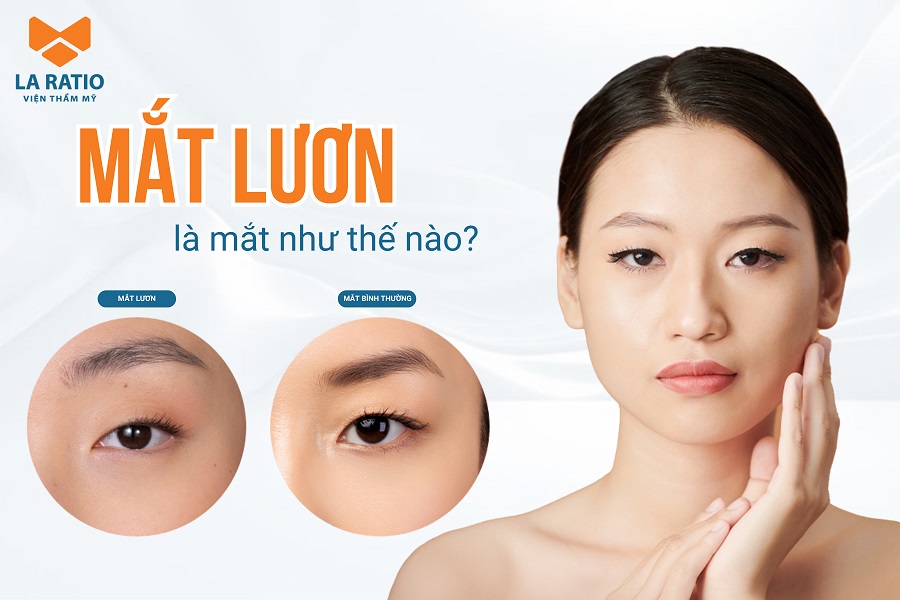 Mắt lươn là gì? Người ti hí mắt lươn là người như thế nào? Mắt lươn là gì? Người ti hí mắt lươn là người như thế nào?
