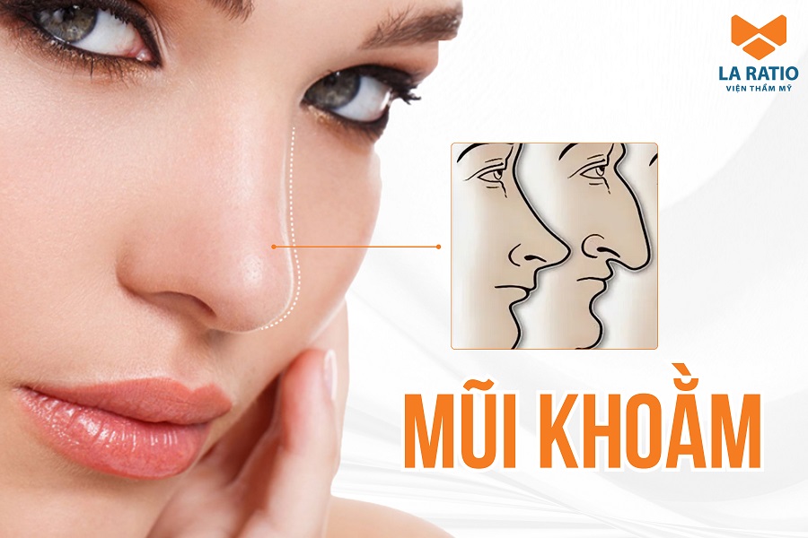 Mũi khoằm là gì? Người mũi khoằm có vận số tốt hay xấu? Mũi khoằm là gì? Người mũi khoằm có vận số tốt hay xấu?
