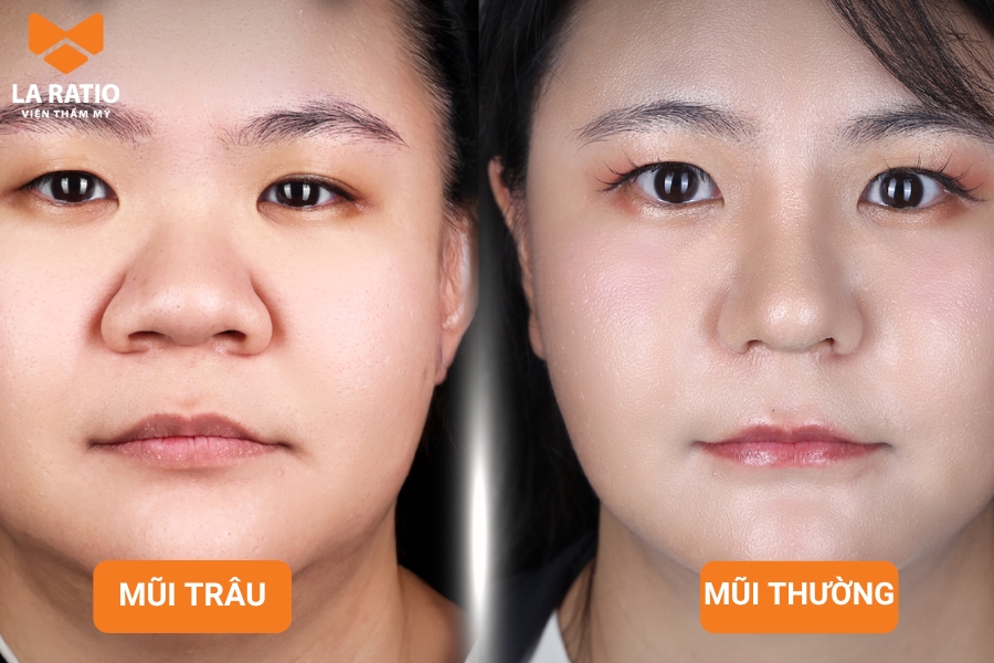 Mũi trâu có kích thước đầy đặn, chiếm phần lớn diện tích trên gương mặt Mũi trâu có kích thước đầy đặn, chiếm phần lớn diện tích trên gương mặt