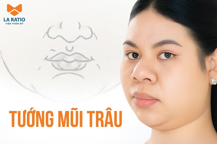 Mũi trâu là gì? Xem tướng mũi trâu ở nam, nữ tốt hay xấu? Mũi trâu là gì? Xem tướng mũi trâu ở nam, nữ tốt hay xấu?