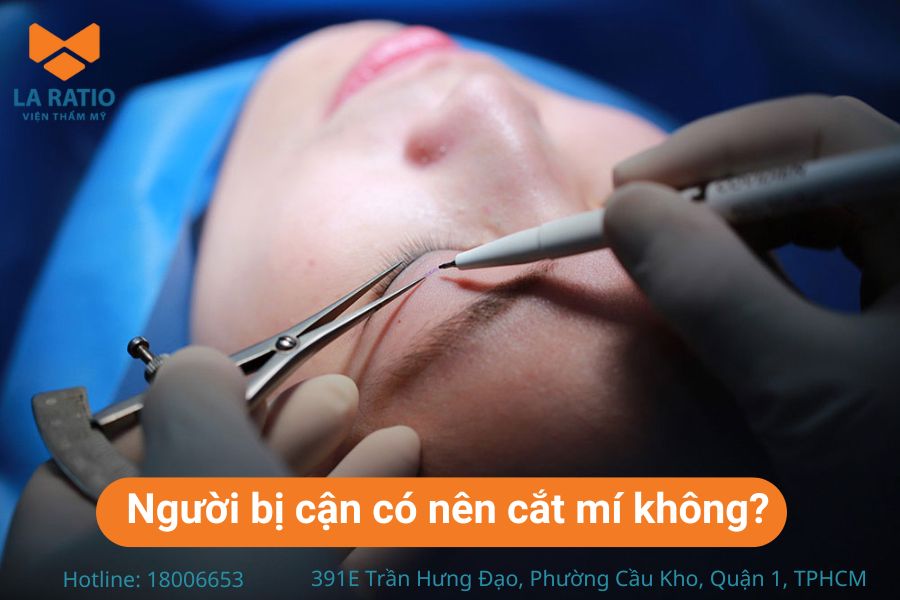 Người bị cận có nên cắt mí không? Theo chuyên gia, người cận vẫn có thể cắt mí Người bị cận có nên cắt mí không? Theo chuyên gia, người cận vẫn có thể cắt mí