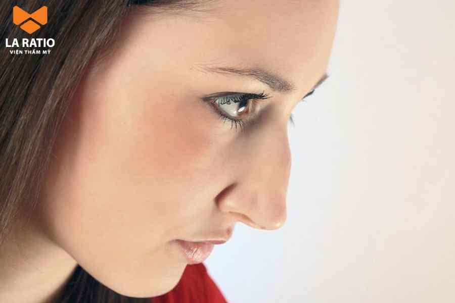 Sống mũi bị gồ có thể do di truyền hoặc do di chứng của chấn thương để lại Sống mũi bị gồ có thể do di truyền hoặc do di chứng của chấn thương để lại