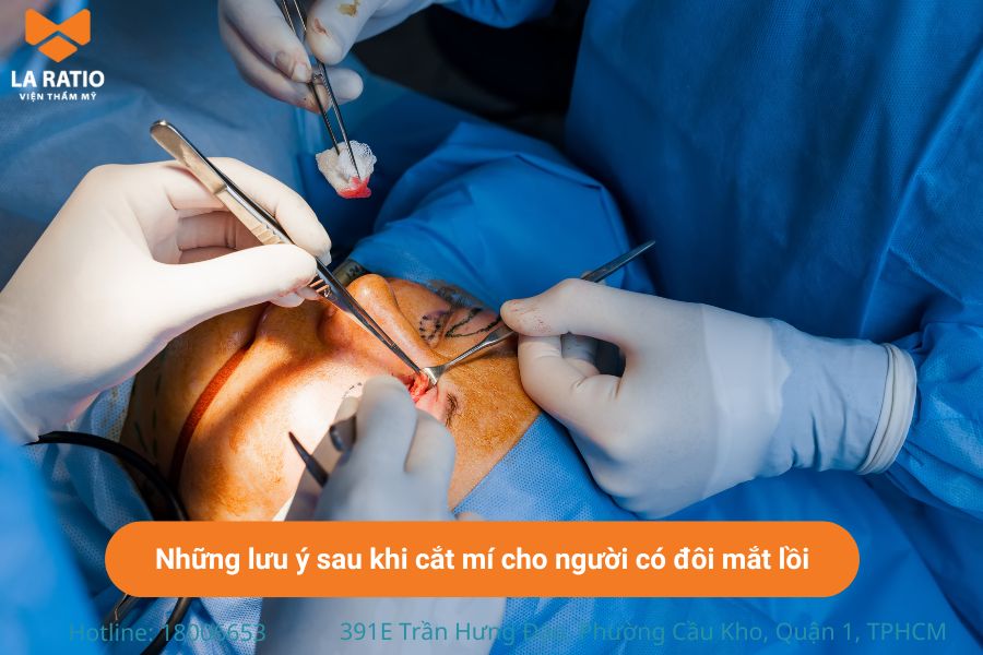 Việc chăm sóc hậu phẫu đúng cách giúp mắt hồi phục nhanh chóng Việc chăm sóc hậu phẫu đúng cách giúp mắt hồi phục nhanh chóng
