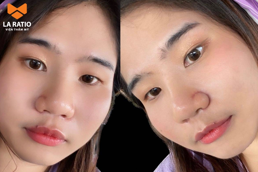 Nữ mũi cà chua - Sống chân thành, bao dung nhưng tình duyên lận đận Nữ mũi cà chua - Sống chân thành, bao dung nhưng tình duyên lận đận