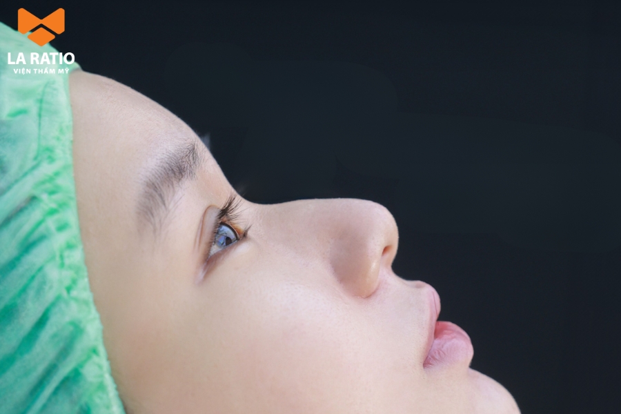 Tướng mũi gãy nữ Tướng mũi gãy nữ