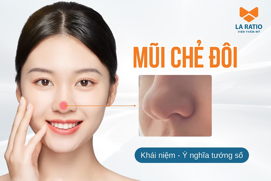 Mũi chẻ là như thế nào? Có ý nghĩa gì? Tốt hay xấu? Mũi chẻ là như thế nào? Có ý nghĩa gì? Tốt hay xấu?