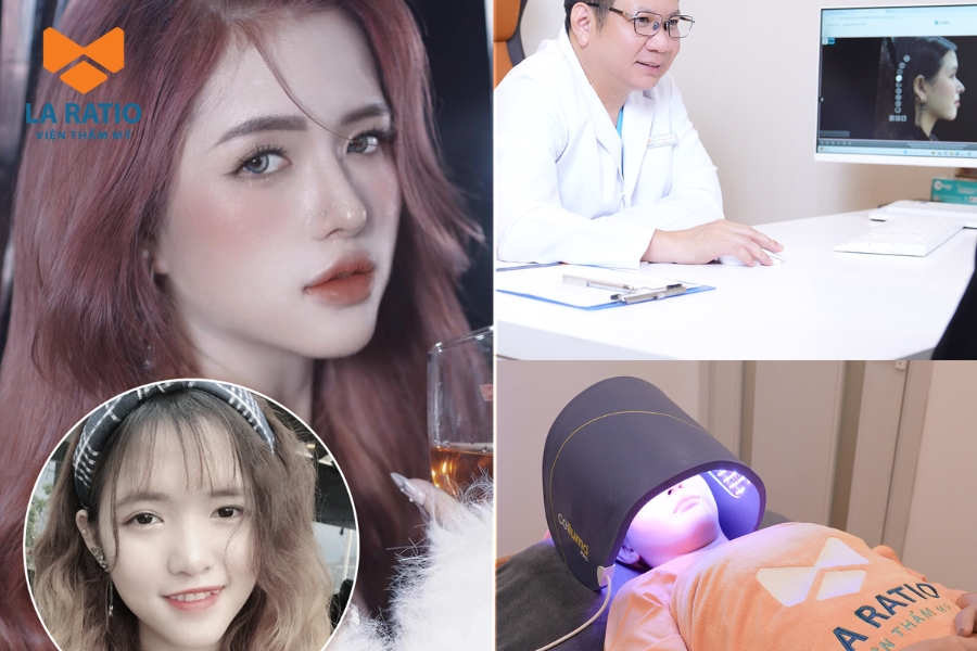 Nâng mũi cao tây cá nhân hóa và an toàn tại Viện thẩm mỹ La Ratio