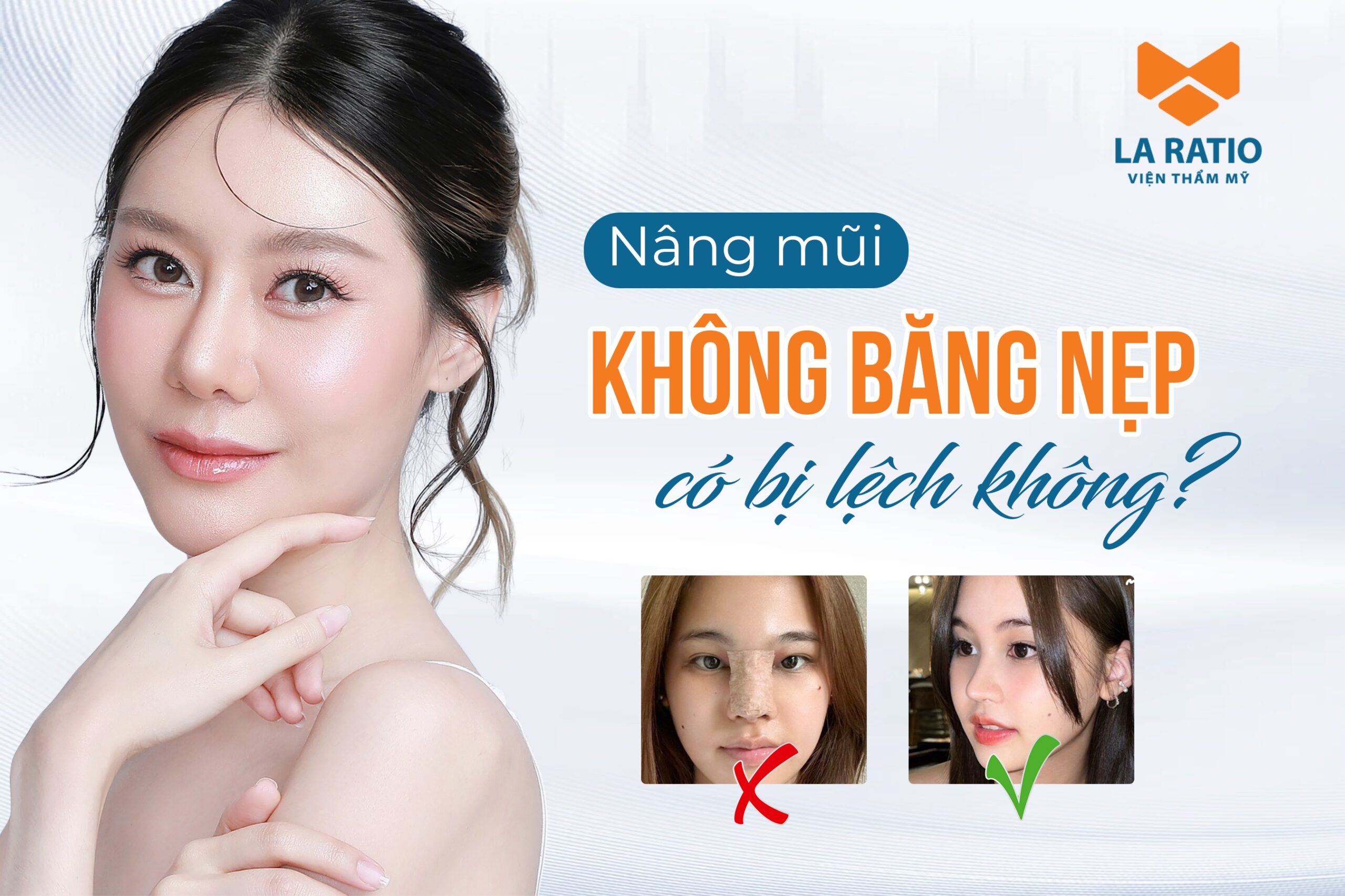 Nâng mũi không băng nẹp có bị lệch không? Nâng mũi không băng nẹp có bị lệch không?