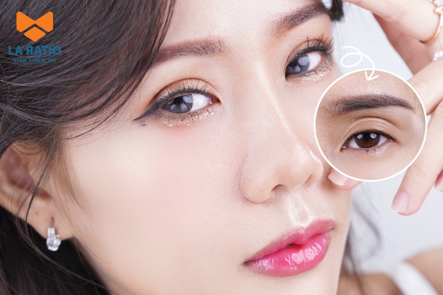 Phẫu thuật thẩm mỹ có thể giúp khắc phục các khuyết điểm của mắt rắn Phẫu thuật thẩm mỹ có thể giúp khắc phục các khuyết điểm của mắt rắn