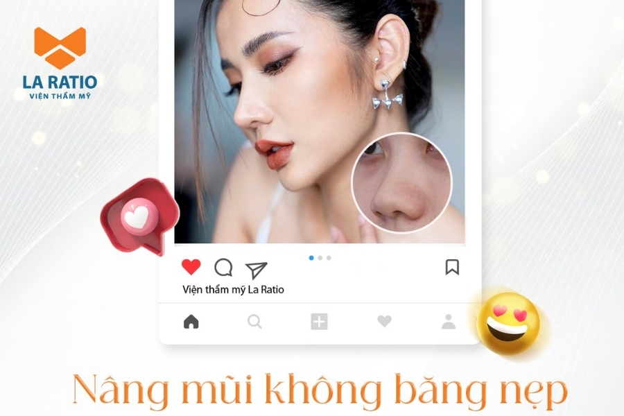 Nâng mũi không băng nẹp không để lại vết tích thẩm mỹ Nâng mũi không băng nẹp không để lại vết tích thẩm mỹ
