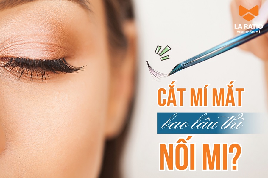 Cắt mí bao lâu thì được nối mi? Chuyên gia La Ratio giải đáp