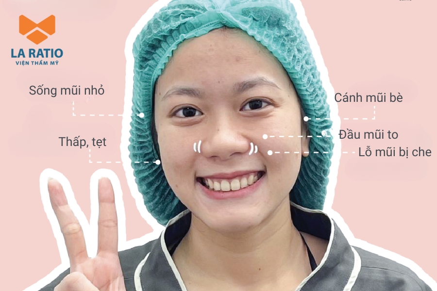 Mũi củ tỏi có đầu mũi tròn, cánh mũi rộng giống như dáng của củ tỏi Mũi củ tỏi có đầu mũi tròn, cánh mũi rộng giống như dáng của củ tỏi