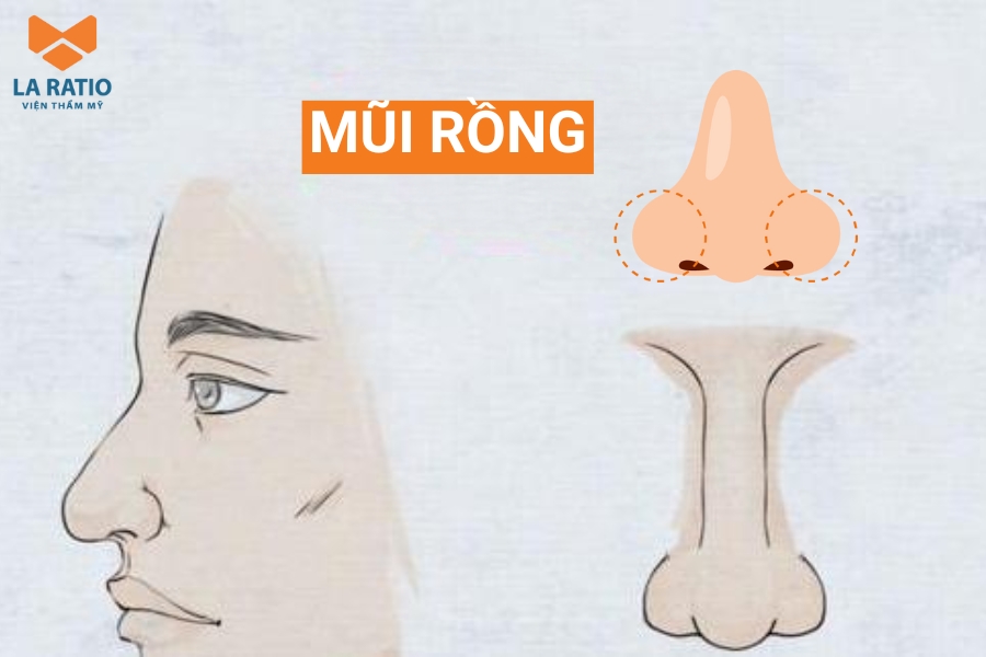 Hình ảnh mũi rồng: Mũi có phần đầu mũi hướng xuống dưới giống như đầu của con rồng Hình ảnh mũi rồng: Mũi có phần đầu mũi hướng xuống dưới giống như đầu của con rồng