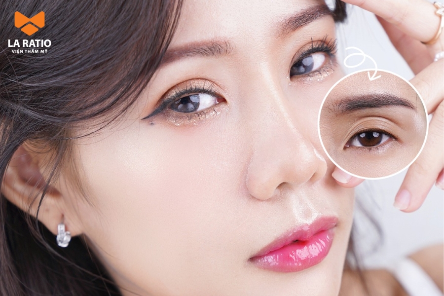 Cắt mí mắt giúp sở hữu đôi mắt đẹp , hài hòa với gương mặt Cắt mí mắt giúp sở hữu đôi mắt đẹp , hài hòa với gương mặt