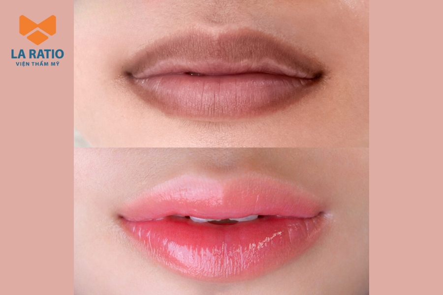 Ảnh thực tế khách hàng ngay sau khi phun môi công nghệ cao