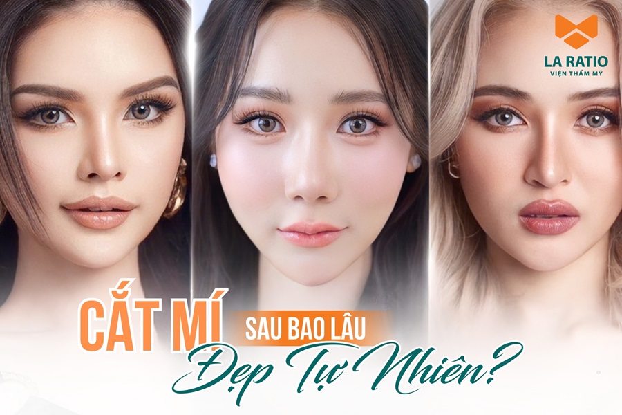 Cắt mí sau bao lâu thì đẹp tự nhiên, mí vào form ổn định