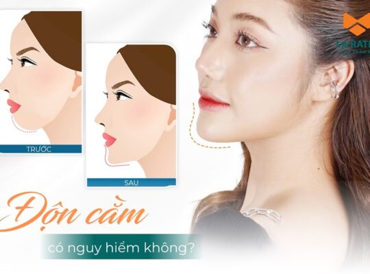 Độn cằm có nguy hiểm không? Có để lại biến chứng gì không?