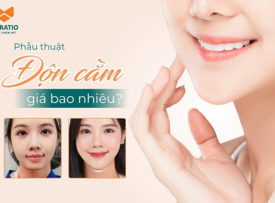 Độn cằm giá bao nhiêu tiền? Bảng giá mới nhất tại La Ratio 2025