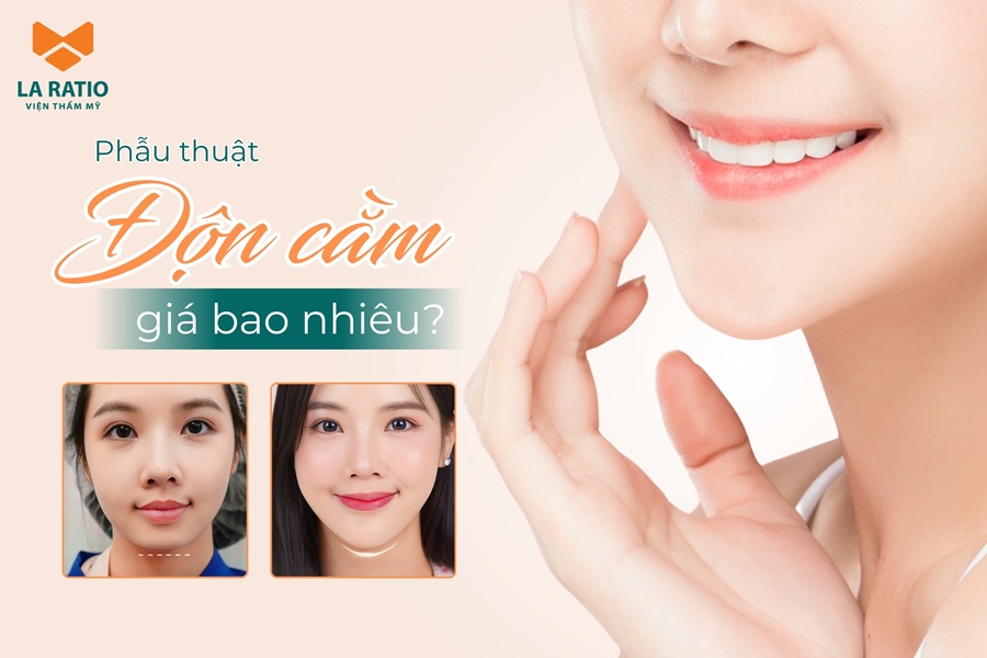 Độn cằm giá bao nhiêu tiền? Bảng giá mới nhất tại La Ratio 2025