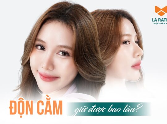 Độn cằm giữ được bao lâu? Có được vĩnh viễn không