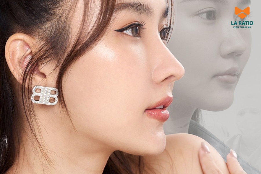 Nâng mũi trả góp giúp khách hàng chia nhỏ số tiền thanh toán