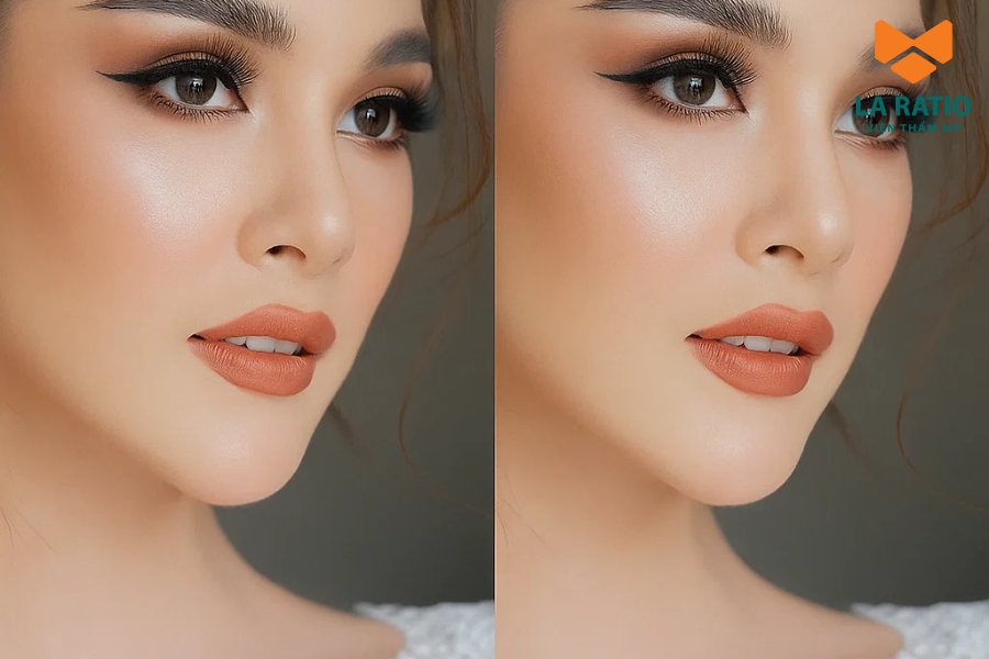 Các biến thể phổ biến của cam đất Các biến thể phổ biến của cam đất