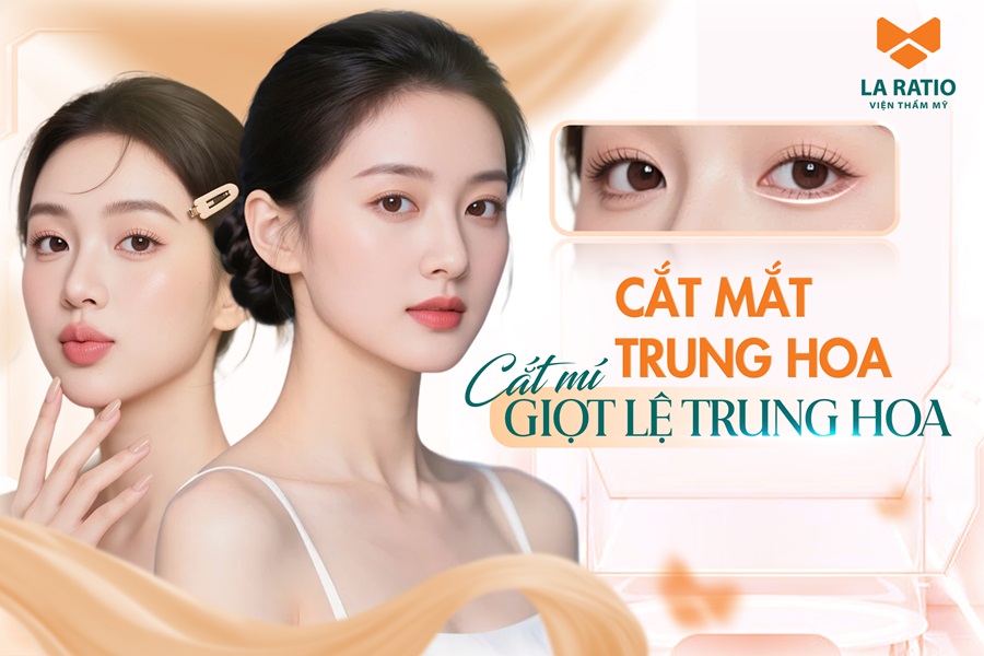 Cắt mắt Trung Hoa - Trào lưu thẩm mỹ Á Đông được nhiều phái đẹp ưa chuộng Cắt mắt Trung Hoa - Trào lưu thẩm mỹ Á Đông được nhiều phái đẹp ưa chuộng