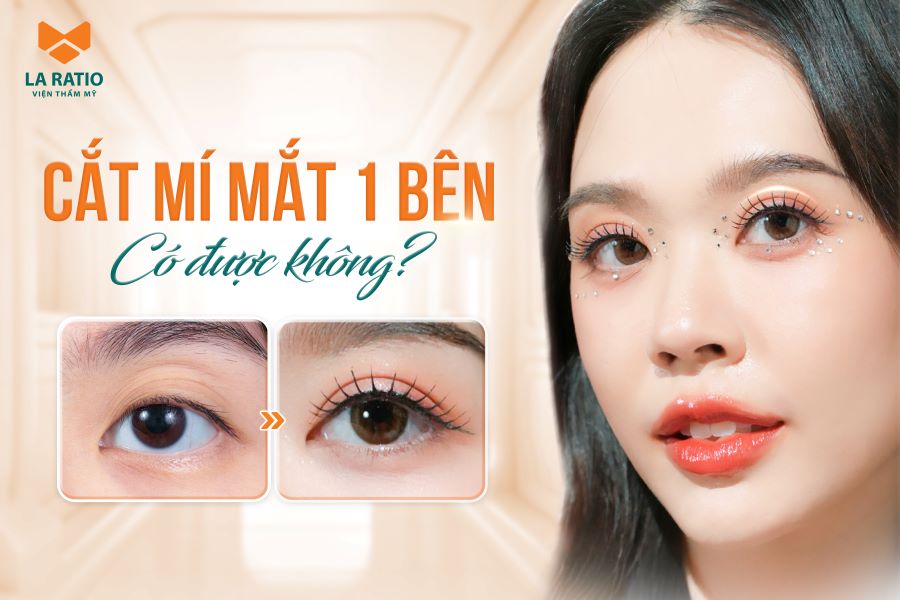 Cắt mí mắt 1 bên có được không? Những thông tin cần lưu ý
