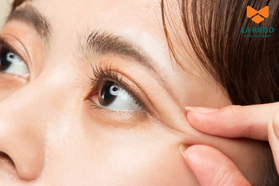 Khách hàng hoàn toàn có thể cắt mí mắt 1 bên để hai mắt cân đối và hài hòa