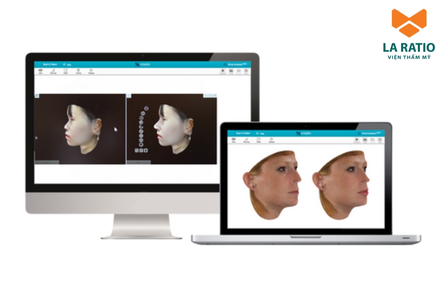 Công nghệ Crisalix mô phỏng dáng mũi trước - sau phẫu thuật Công nghệ Crisalix mô phỏng dáng mũi trước - sau phẫu thuật