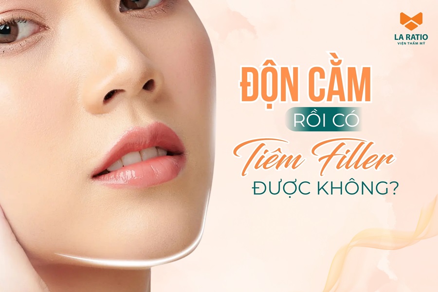 Độn cằm rồi có tiêm filler được không? La Ratio giải đáp Độn cằm rồi có tiêm filler được không? La Ratio giải đáp