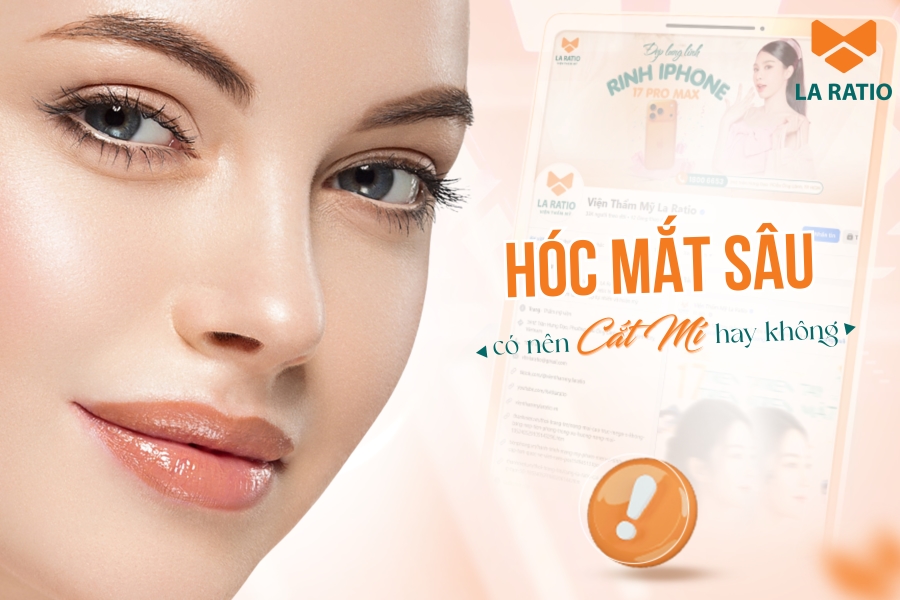 Hốc mắt sâu có nên cắt mí mắt? Chuyên gia La Ratio giải đáp