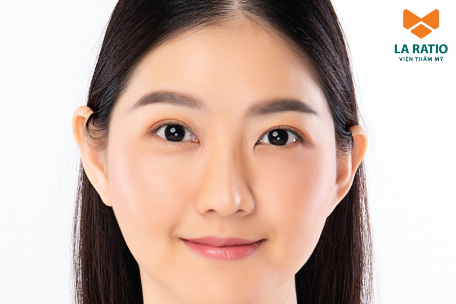 Nâng mũi sẽ giúp gương mặt tròn thon gọn và hài hòa hơn Nâng mũi sẽ giúp gương mặt tròn thon gọn và hài hòa hơn