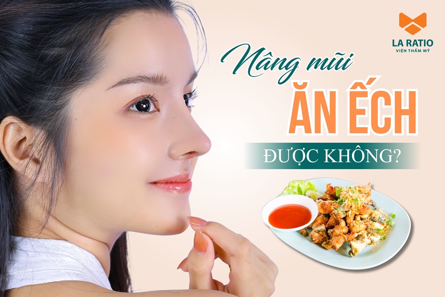 Nâng mũi ăn ếch được không? Chuyên gia La Ratio giải đáp Nâng mũi ăn ếch được không? Chuyên gia La Ratio giải đáp