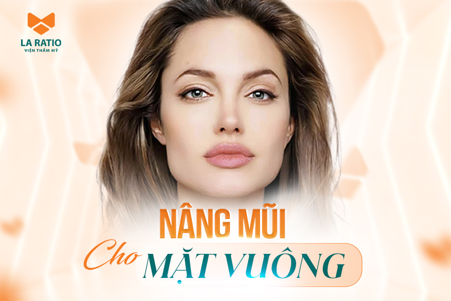 Mặt vuông có nên nâng mũi? Kỹ thuật nâng mũi cho mặt vuông Mặt vuông có nên nâng mũi? Kỹ thuật nâng mũi cho mặt vuông