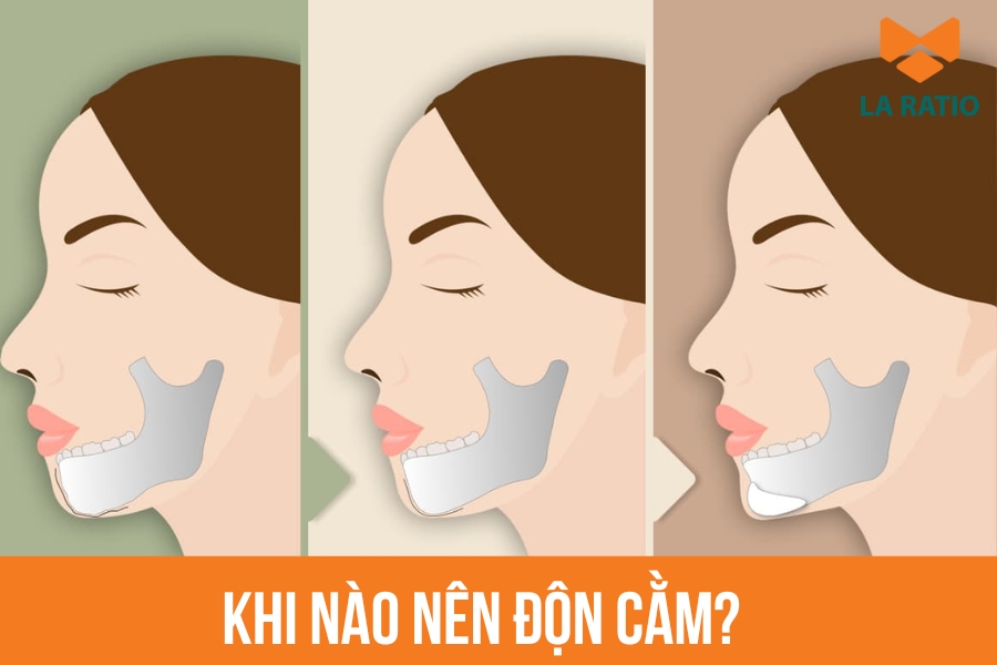 Bạn nên độn cằm khi khuôn mặt mất cân đối do cằm ngắn, lẹm hoặc thiếu độ nhô
