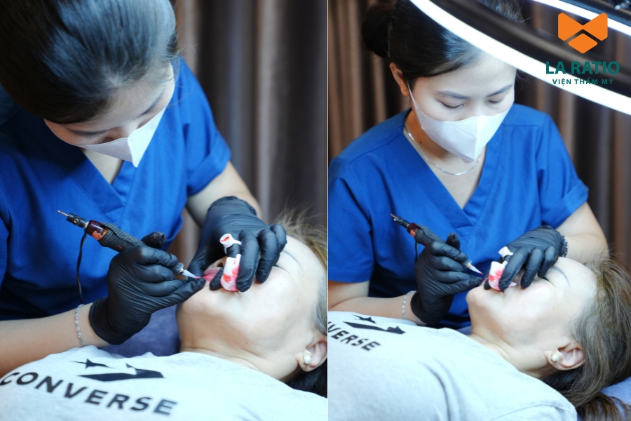 Quy trình phun môi an toàn, chuẩn Y Khoa tại Viện thẩm mỹ La Ratio Quy trình phun môi an toàn, chuẩn Y Khoa tại Viện thẩm mỹ La Ratio