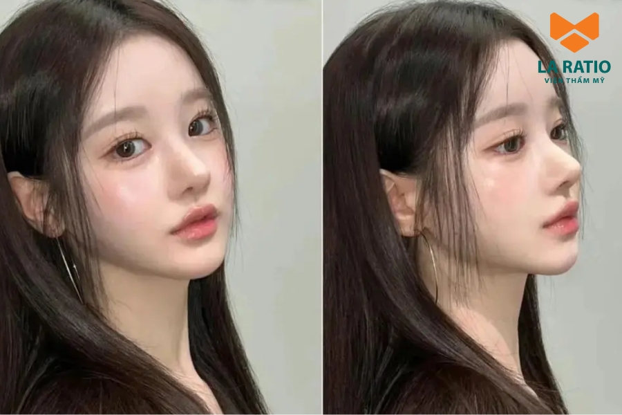 Cắt mí Trung Hoa tạo hiệu ứng “giọt lệ” giúp đôi mắt to, long lanh và đầy cuốn hút Cắt mí Trung Hoa tạo hiệu ứng “giọt lệ” giúp đôi mắt to, long lanh và đầy cuốn hút